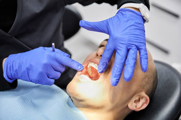 Best Broken or Cracked Tooth Emergency Dentist in Toppenish, WA